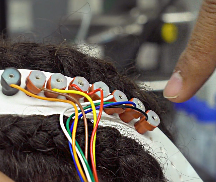 Non-invasive EEG monitoring device